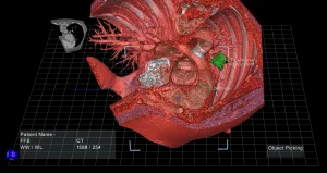 Les médecins pourront bientôt étudier les organes dans une réalité virtuelle en 3D avant d’opérer