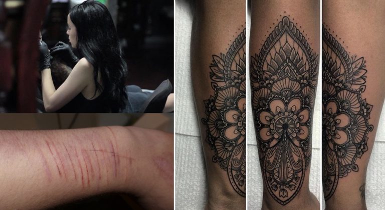 Des tatouages gratuits pour couvrir les cicatrices automutilées