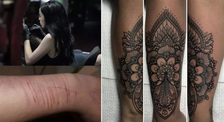 Des tatouages gratuits pour couvrir les cicatrices automutilées