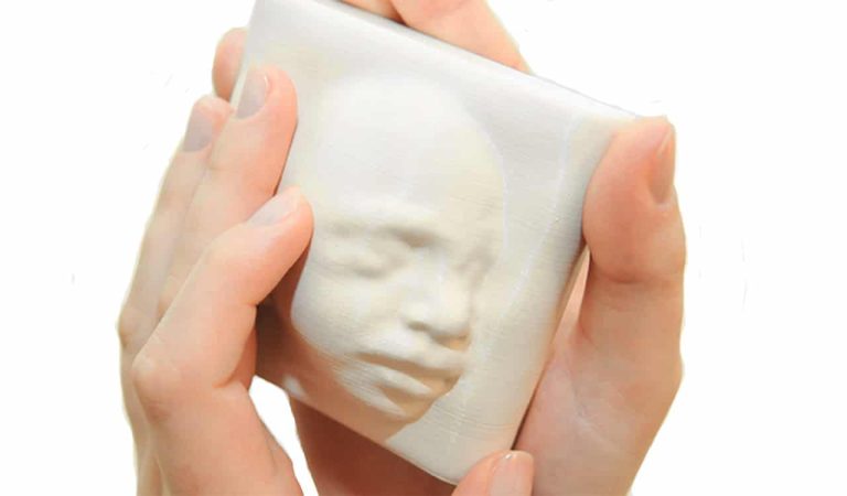 Des mères aveugles qui « voient » les échographies grâce à l’impression en 3D