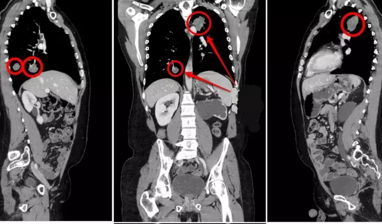 Une intelligence artificielle qui analyse les supports d’imagerie médicale pour des résultats approfondis