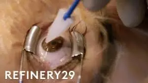 Au Népal, ce chirurgien redonne la vue à 130 000 personnes grâce à des lentilles ultra-performantes