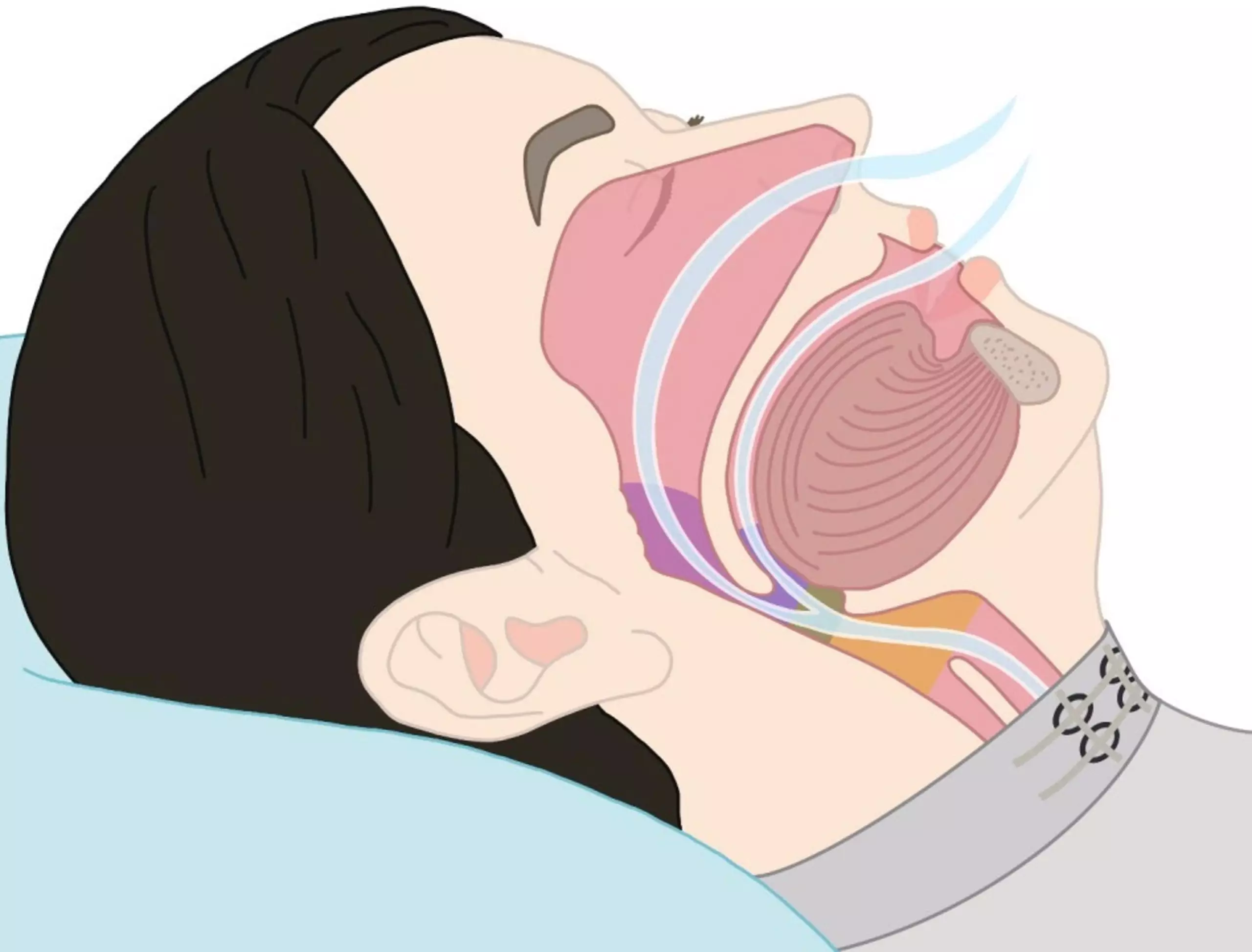 Les capteurs du vêtement perçoivent les vibrations subtiles transmises aux muscles laryngés extrinsèques (dans le cou) depuis d'autres zones anatomiques comme le voile du palais, l'oropharynx, la langue et l'épiglotte