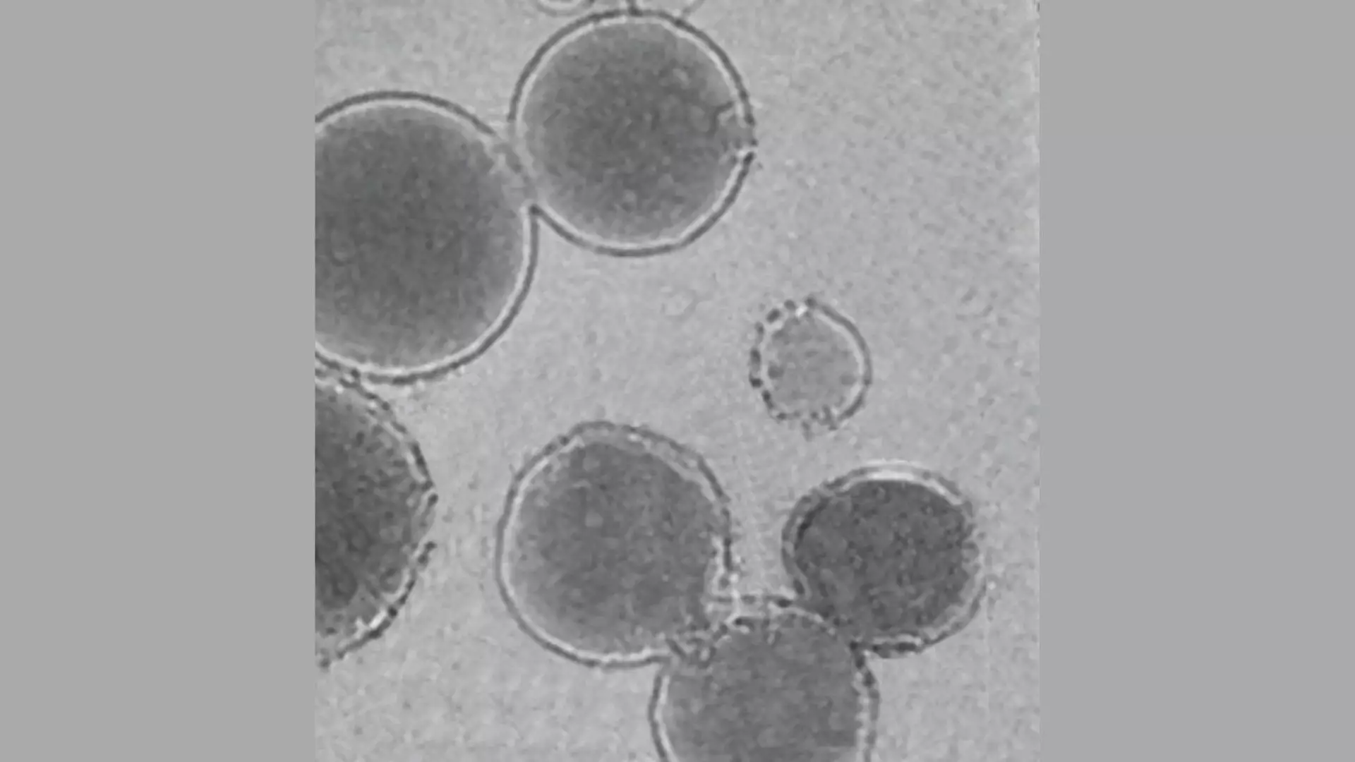 Image MET des liposomes réactifs au froid avec un agent réticulant de l'équipe. // Source : Elham Davoodi et Wei Gao